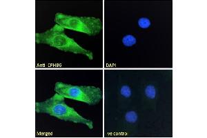 ABIN7013872 Immunofluorescence analysis of paraformaldehyde fixed HeLa cells, permeabilized with 0. (EPH Receptor B6 antibody  (Internal Region))