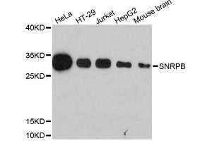 Western blot analysis of extracts of various cell lines, using SNRPB antibody (ABIN5995789) at 1:3000 dilution. (SNRPB antibody)
