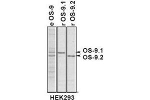 Immunoprecipitation of OS9 in 293 cells expressing OS9. (OS9 antibody  (AA 300-400))
