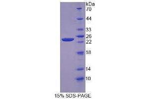 SDS-PAGE (SDS) image for Anoctamin 2 (ANO2) (AA 823-1003) protein (His tag) (ABIN4989475) (Anoctamin 2 Protein (ANO2) (AA 823-1003) (His tag))