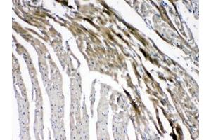 IHC testing of FFPE mouse heart tissue with GJC1 antibody at 1ug/ml.