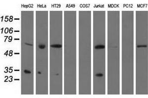 Western blot analysis of extracts (35 µg) from 9 different cell lines by using anti-PYCR2 monoclonal antibody. (PYCR2 antibody)