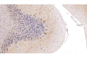 Detection of CALB in Human Cerebellum Tissue using Polyclonal Antibody to Calbindin (CALB) (CALB1 antibody  (AA 3-261))