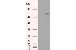 Image no. 7 for anti-Bruton Agammaglobulinemia tyrosine Kinase (BTK) antibody (ABIN1496974) (BTK antibody)