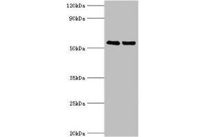 Western blot All lanes: TRIM27 antibody at 4 μg/mL Lane 1: Jurkat whole cell lysate Lane 2: HepG2 whole cell lysate Secondary Goat polyclonal to rabbit IgG at 1/10000 dilution Predicted band size: 59, 42 kDa Observed band size: 59 kDa (TRIM27 antibody  (AA 214-513))