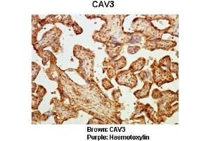 Sample Type :  Human placental tissue   Primary Antibody Dilution :   1:50  Secondary Antibody :  Goat anti rabbit-HRP   Secondary Antibody Dilution :   1:10,000  Color/Signal Descriptions :  Brown: CAV3 Purple: Haemotoxylin  Gene Name :  CAV3  Submitted by :  Dr. (Caveolin 3 antibody  (N-Term))