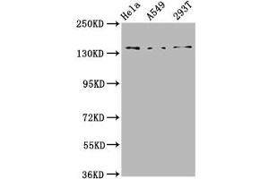 Western Blot Positive WB detected in: Hela whole cell lysate, A549 whole cell lysate, 293T whole cell lysate All lanes: CNGB1 antibody at 4. (GARP antibody  (AA 131-253))