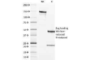 SDS-PAGE Analysis of Purified CD68 Mouse Monoclonal Antibody ABIN6383883. (CD68 antibody  (Extracellular Domain))
