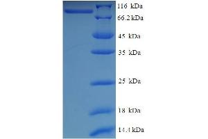 Coiled-Coil Domain Containing 41 (CCDC41) (AA 1-568) protein (His-SUMO Tag)