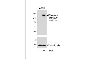 Western blot analysis of lysates from A431 cell line, untreated or treated with EGF, 100 ng/mL, using Phospho-TrkA Antibody (ABIN389679 and ABIN2839650) (upper) or Beta-Tubulin (lower).