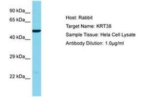 Image no. 1 for anti-Keratin 38 (KRT38) (AA 206-255) antibody (ABIN6750574) (KRT38 antibody  (AA 206-255))