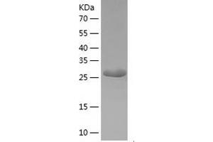 Western Blotting (WB) image for BCDIN3 Domain Containing (BCDIN3D) (AA 1-292) protein (His tag) (ABIN7287766) (BCDIN3D Protein (AA 1-292) (His tag))