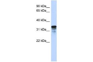 Western Blotting (WB) image for anti-Regulator of Microtubule Dynamics 1 (RMDN1) antibody (ABIN2458997)