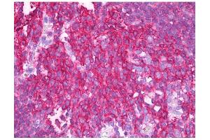 Image no. 1 for anti-Synaptosomal-Associated Protein, 23kDa (SNAP23) antibody (ABIN347010) (SNAP23 antibody)