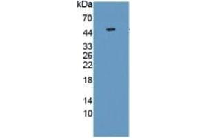 Western Blotting (WB) image for Vimentin (VIM) ELISA Kit (ABIN6574248)