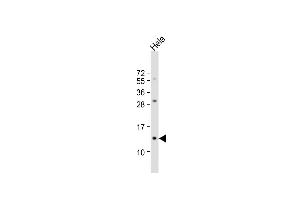 Anti-B2M Antibody (N-term) at 1:1000 dilution + Hela whole cell lysate Lysates/proteins at 20 μg per lane. (beta-2 Microglobulin antibody  (N-Term))