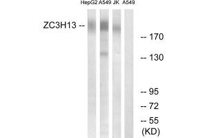 Western blot analysis of extracts from HepG2 cells, A549 cells and Jurkat cells, using ZC3H13 antibody. (ZC3H13 antibody  (C-Term))