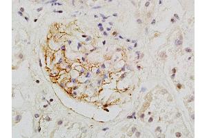 Formalin-fixed and paraffin embedded human kidney labeled with Rabbit Anti-PCX/PODXL Polyclonal Antibody, Unconjugated  at 1:200 followed by conjugation to the secondary antibody and DAB staining (PODXL antibody  (AA 451-558))