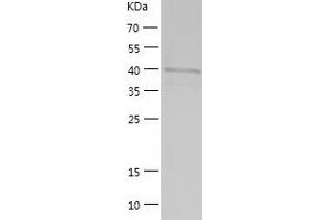 Western Blotting (WB) image for Adenosylhomocysteinase (AHCY) (AA 1-432) protein (His tag) (ABIN7286348) (AHCY Protein (AA 1-432) (His tag))