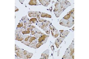 Immunohistochemistry of paraffin-embedded mouse heart using MRPS6 antibody (ABIN6003616) at dilution of 1/100 (40x lens). (MRPS6 antibody)