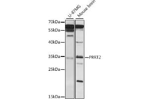 Western blot analysis of extracts of various cell lines, using PRRT2 antibody (ABIN7269559) at 1:1000 dilution. (PRRT2 antibody  (AA 20-130))