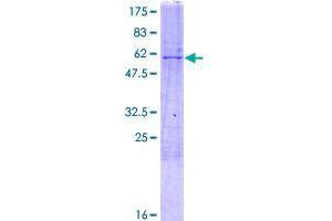 Image no. 1 for Docking Protein 5 (DOK5) (AA 1-306) protein (GST tag) (ABIN1351906) (DOK5 Protein (AA 1-306) (GST tag))