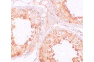 Immunohistochemical staining of human testis cells with YBX2 polyclonal antibody  at 10 ug/mL. (YBX2 antibody  (C-Term))