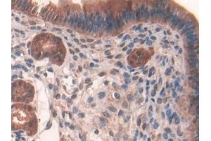 Detection of GR in Mouse Uterus Tissue using Polyclonal Antibody to Glutathione Reductase (GR) (Glutathione Reductase antibody  (AA 240-500))