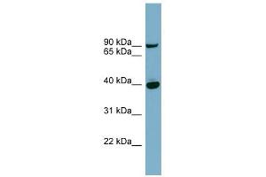 PNPLA8 antibody used at 1 ug/ml to detect target protein. (PNPLA8 antibody  (Middle Region))