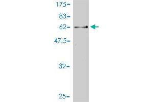Western Blot detection against Immunogen (61. (CDK13 antibody  (AA 1-324))