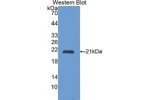 Western Blotting (WB) image for anti-Cathepsin L1 (CTSL1) (AA 114-288) antibody (ABIN1172740) (Cathepsin L antibody  (AA 114-288))
