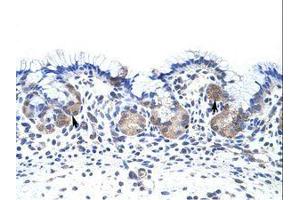 Image no. 1 for anti-UPF3 Regulator of Nonsense Transcripts Homolog B (UPF3B) (N-Term) antibody (ABIN203166) (UPF3B antibody  (N-Term))