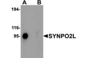 Western blot analysis of SYNPO2L in human thymus tissue lysate with SYNPO2L antibody at 1 μg/ml in (A) the absence and (B) the presence of blocking peptide. (SYNPO2L antibody  (N-Term))
