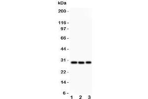 Western blot testing of CSEN antibody and Lane 1:  HeLa;  2: U87;  3: SHG-44 lysate. (DREAM antibody  (N-Term))