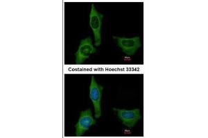 ICC/IF Image Immunofluorescence analysis of methanol-fixed HeLa, using Factor X, antibody at 1:200 dilution. (Coagulation Factor X antibody)