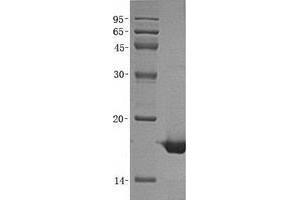 Validation with Western Blot (ACP1 Protein (Transcript Variant 3) (His tag))