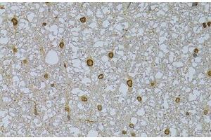 Immunohistochemistry of paraffin-embedded Rat spinal cord using HDGFRP3 Polyclonal Antibody at dilution of 1:100 (40x lens). (HDGFRP3 antibody)
