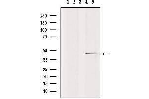 CK1 epsilon antibody  (Internal Region)