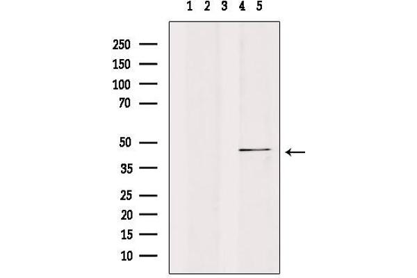 CK1 epsilon antibody  (Internal Region)