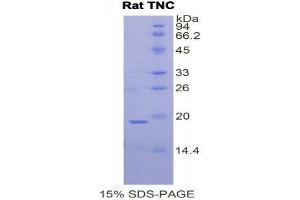 SDS-PAGE (SDS) image for Tenascin C (TNC) (AA 356-495) protein (His tag) (ABIN1877553) (TNC Protein (AA 356-495) (His tag))