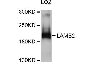 Western blot analysis of extracts of LO2 cells, using LAMB2 antibody. (LAMB2 antibody)