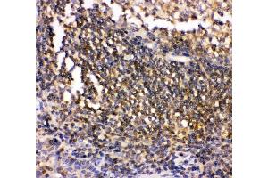 anti-C-Src tyrosine Kinase (CSK) (AA 2-204) antibody