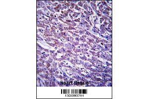 XIRP1 Antibody immunohistochemistry analysis in formalin fixed and paraffin embedded human heart tissue followed by peroxidase conjugation of the secondary antibody and DAB staining. (XIRP1 antibody  (C-Term))