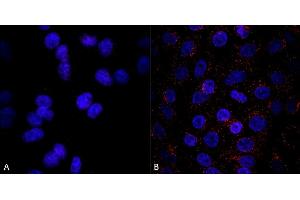 Immunocytochemistry (ICC) image for anti-Vacuolar Protein Sorting 35 (VPS35) antibody (Atto 594) (ABIN6932960)
