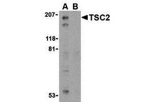 Western Blotting (WB) image for anti-Tuberous Sclerosis 2 (TSC2) (C-Term) antibody (ABIN1030781) (Tuberin antibody  (C-Term))