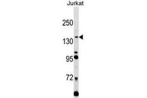 Western blot analysis in Jurkat cell line lysates (35ug/lane) using CD171 / L1CAM Antibody . (L1CAM antibody  (C-Term))