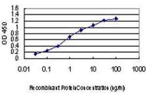 Detection limit for recombinant GST tagged IRAK2 is approximately 0. (IRAK2 antibody  (AA 111-210))