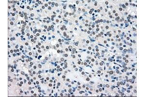 Immunohistochemical staining of paraffin-embedded pancreas tissue using anti-BRAFmouse monoclonal antibody. (BRAF antibody)