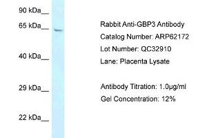 Western Blotting (WB) image for anti-Guanylate Binding Protein 3 (GBP3) (N-Term) antibody (ABIN2789048) (GBP3 antibody  (N-Term))
