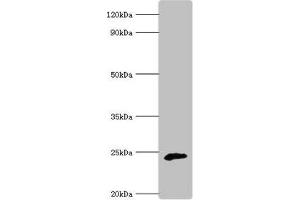 Western blot All lanes: Ubiquinone biosynthesis protein COQ7 homolog antibody at 6 μg/mL + Rat heart tissue Secondary Goat polyclonal to rabbit IgG at 1/10000 dilution Predicted band size: 25, 21 kDa Observed band size: 25 kDa (Coq7 antibody  (AA 37-217))